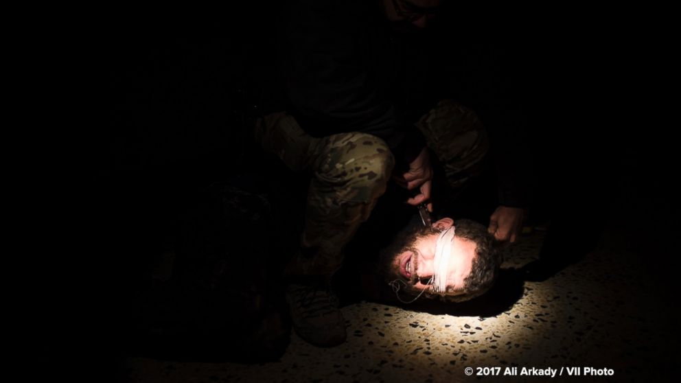 PHOTO: A soldier who claimed to be a U.S. contractor directed the torture of this man, employing a torture technique he said he was taught by U.S. interrogators.
